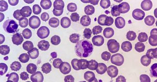 Erythrocytes (red blood cells): characteristics and function