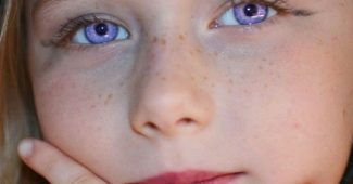 Alexandria Syndrome: the "rare condition" of purple eyes
