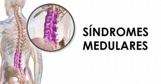 Spinal cord syndromes: types, causes, and symptoms